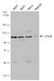 CYLD Lysine 63 Deubiquitinase antibody, GTX113662, GeneTex, Western Blot image 