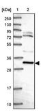 Coiled-coil domain-containing protein 106 antibody, PA5-60281, Invitrogen Antibodies, Western Blot image 