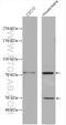 ABI Family Member 3 Binding Protein antibody, 27727-1-AP, Proteintech Group, Western Blot image 