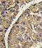 Vitronectin antibody, LS-C100669, Lifespan Biosciences, Immunohistochemistry frozen image 