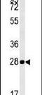 Mitochondrial RRNA Methyltransferase 1 antibody, PA5-23887, Invitrogen Antibodies, Western Blot image 