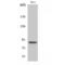 Signal Transducer And Activator Of Transcription 5A antibody, LS-C381205, Lifespan Biosciences, Western Blot image 