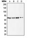 Ribosomal Protein S6 Kinase B1 antibody, orb214542, Biorbyt, Western Blot image 