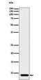 ATP synthase lipid-binding protein, mitochondrial antibody, M32382, Boster Biological Technology, Western Blot image 