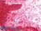 Galectin 7B antibody, LS-C211355, Lifespan Biosciences, Immunohistochemistry paraffin image 