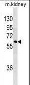 Sprouty Related EVH1 Domain Containing 1 antibody, LS-C157081, Lifespan Biosciences, Western Blot image 