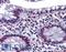 Checkpoint Kinase 2 antibody, LS-B6212, Lifespan Biosciences, Immunohistochemistry frozen image 