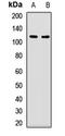 Ubiquitin Like Modifier Activating Enzyme 1 antibody, LS-C668081, Lifespan Biosciences, Western Blot image 