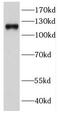 DEAD-Box Helicase 24 antibody, FNab02301, FineTest, Western Blot image 