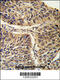 Chaperonin Containing TCP1 Subunit 3 antibody, 61-581, ProSci, Immunohistochemistry paraffin image 