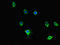 Protein Arginine Methyltransferase 5 antibody, LS-C679182, Lifespan Biosciences, Immunofluorescence image 