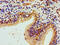 Histone Cluster 1 H1 Family Member E antibody, LS-C670375, Lifespan Biosciences, Immunohistochemistry paraffin image 