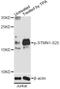 Stathmin 1 antibody, STJ22421, St John