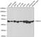 Proteasome 26S Subunit, ATPase 4 antibody, GTX54612, GeneTex, Western Blot image 