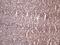 Inhibitor Of Nuclear Factor Kappa B Kinase Subunit Epsilon antibody, NBP2-46047, Novus Biologicals, Immunohistochemistry paraffin image 