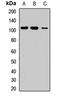 Receptor Tyrosine Kinase Like Orphan Receptor 1 antibody, LS-C668224, Lifespan Biosciences, Western Blot image 