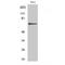 Adrenoceptor Beta 2 antibody, LS-C382171, Lifespan Biosciences, Western Blot image 