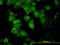 Glutamate-Cysteine Ligase Catalytic Subunit antibody, LS-C197304, Lifespan Biosciences, Immunofluorescence image 