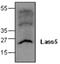 Ceramide Synthase 5 antibody, GTX59779, GeneTex, Western Blot image 