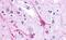 Cadherin EGF LAG Seven-Pass G-Type Receptor 2 antibody, NLS1942, Novus Biologicals, Immunohistochemistry frozen image 