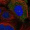 Serologically Defined Colon Cancer Antigen 8 antibody, NBP2-55249, Novus Biologicals, Immunocytochemistry image 