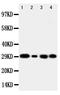 Carbonic Anhydrase 1 antibody, PA1425, Boster Biological Technology, Western Blot image 