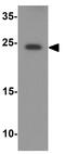 DIRAS Family GTPase 3 antibody, GTX17241, GeneTex, Western Blot image 