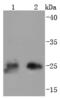 Thymidine Kinase 1 antibody, A04850-2, Boster Biological Technology, Western Blot image 