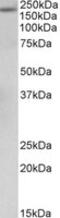 Alpha-2-Macroglobulin antibody, MBS423242, MyBioSource, Western Blot image 