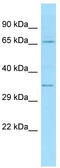 Taxilin Alpha antibody, TA337756, Origene, Western Blot image 