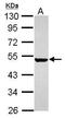 Keratin-5 antibody, GTX120881, GeneTex, Western Blot image 