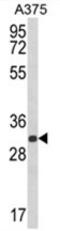Deoxyribose-Phosphate Aldolase antibody, AP17986PU-N, Origene, Western Blot image 