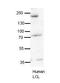 Synaptojanin 1 antibody, A04358-1, Boster Biological Technology, Western Blot image 