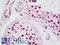 TERF2 Interacting Protein antibody, LS-B11052, Lifespan Biosciences, Immunohistochemistry frozen image 