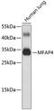 Microfibril Associated Protein 4 antibody, 19-227, ProSci, Western Blot image 