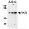 Eukaryotic Translation Initiation Factor 2 Alpha Kinase 2 antibody, MBS150276, MyBioSource, Western Blot image 