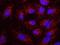 Casein Kinase 1 Alpha 1 antibody, NBP1-18880, Novus Biologicals, Proximity Ligation Assay image 