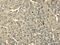 Tribbles Pseudokinase 2 antibody, CSB-PA172809, Cusabio, Immunohistochemistry paraffin image 