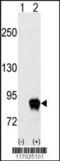 G Protein-Coupled Receptor Kinase 2 antibody, LS-C97473, Lifespan Biosciences, Western Blot image 