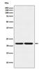 Chromobox 3 antibody, M01142-1, Boster Biological Technology, Western Blot image 