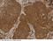 NME1 antibody, 11615-R084, Sino Biological, Immunohistochemistry paraffin image 