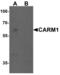 Coactivator Associated Arginine Methyltransferase 1 antibody, LS-B10076, Lifespan Biosciences, Western Blot image 