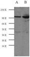 RB Transcriptional Corepressor 1 antibody, MBS440043, MyBioSource, Western Blot image 