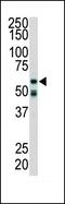 Receptor Interacting Serine/Threonine Kinase 2 antibody, PA5-14954, Invitrogen Antibodies, Western Blot image 