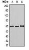 MutY DNA Glycosylase antibody, LS-C354036, Lifespan Biosciences, Western Blot image 