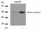 Keratin 8 antibody, PA5-37623, Invitrogen Antibodies, Western Blot image 