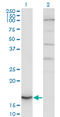 Cytochrome B5 Type A antibody, LS-B6526, Lifespan Biosciences, Western Blot image 