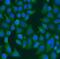 Keratin 6B antibody, FNab04656, FineTest, Immunofluorescence image 