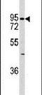 Cadherin 6 antibody, PA5-11456, Invitrogen Antibodies, Western Blot image 