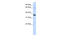 ST6 N-Acetylgalactosaminide Alpha-2,6-Sialyltransferase 1 antibody, 26-232, ProSci, Enzyme Linked Immunosorbent Assay image 